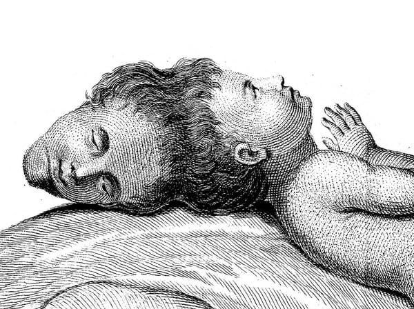 The Extraordinary Tale of a Head Born Without a Body
